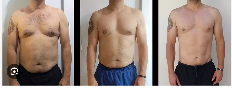 Client 1 body recomposition: waist reduction and improved posture (before and after)