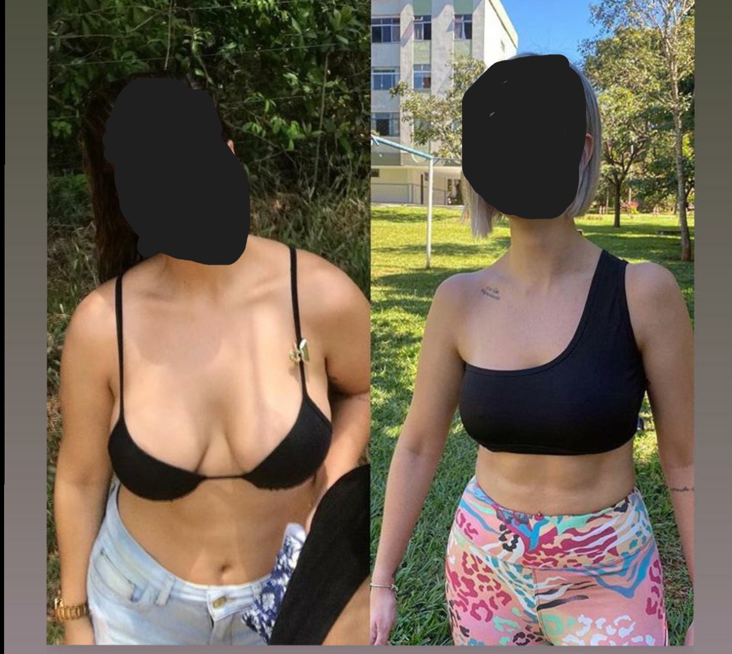 Client 15 abdominal definition and posture refinement (before and after)