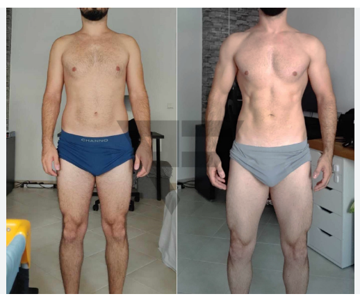 Client 4 abdominal fat loss and upper body shape improvement (before and after)